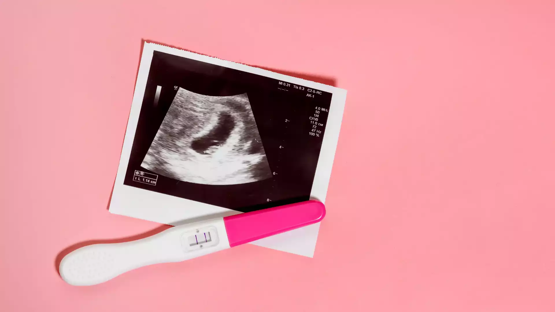 Gebelikte düşük neden olur, hamilelikte düşük riskleri