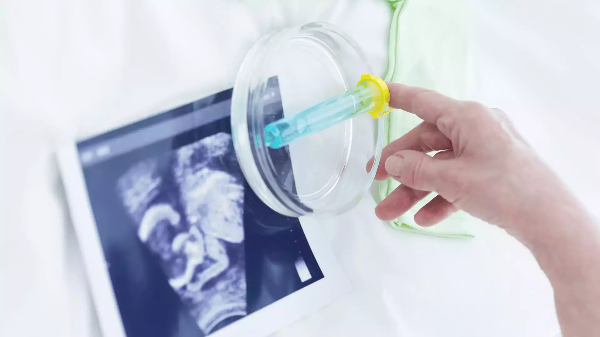 Tüp bebek tedavisi sonrası tutma belirtileri, gebelik süreci